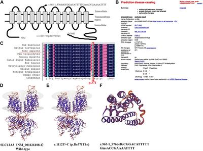 Novel compound heterozygous variants of SLC12A3 gene in a Chinese patient with Gitelman syndrome: a case report